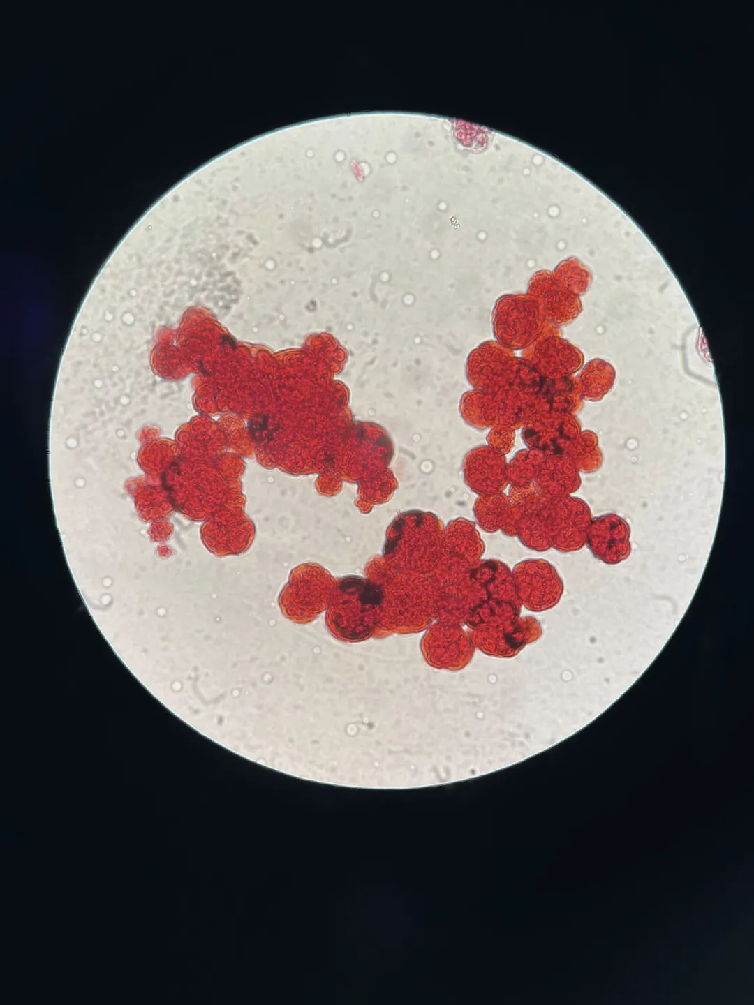 Stained cells under a microscope.